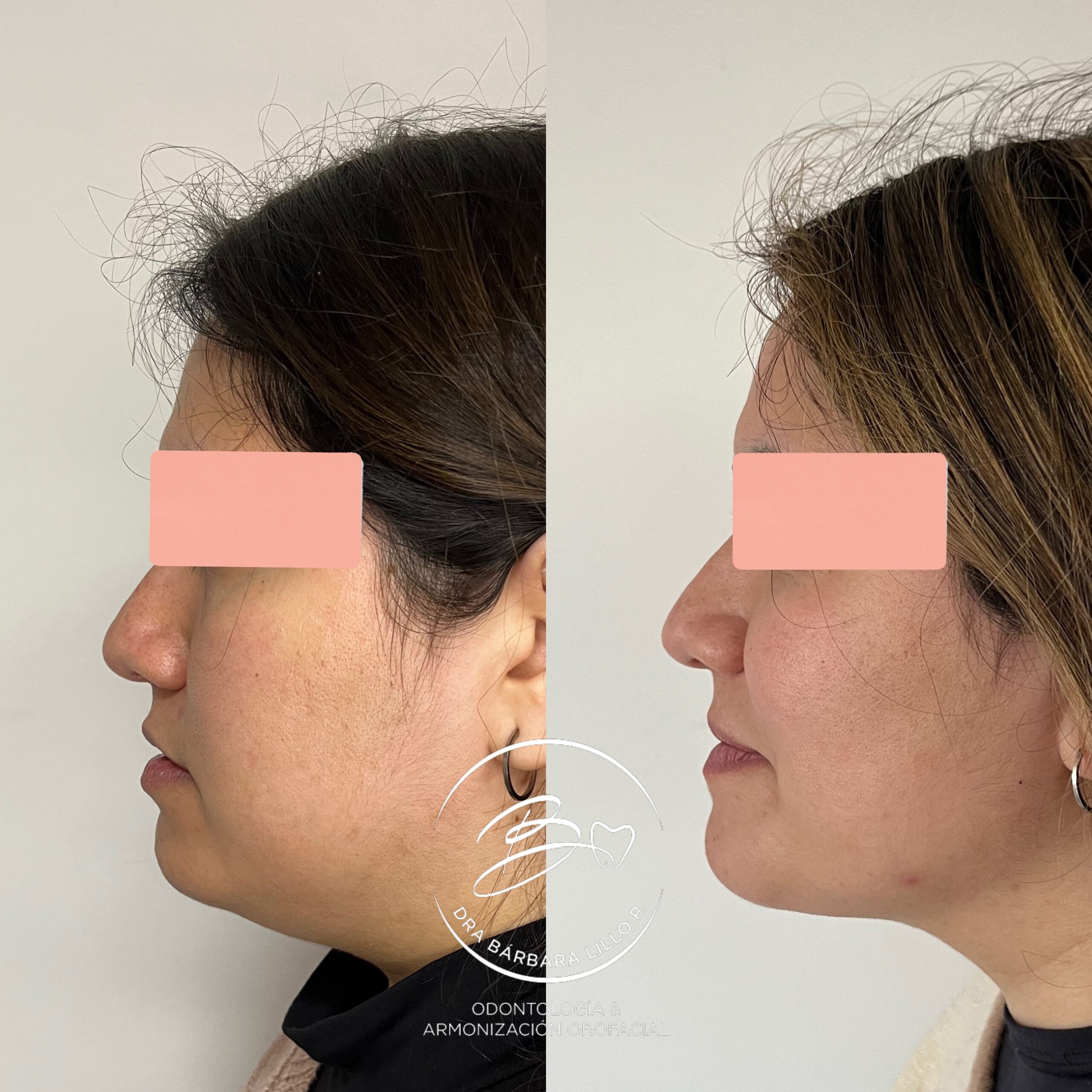 lipopapada(1)