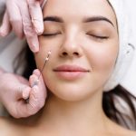Face lifting PDO Suture operation. innovative technique of New thread lift, cosmetologist preparing to do procedure to female client, select the appropriate thread option