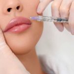 Perfilado de labios