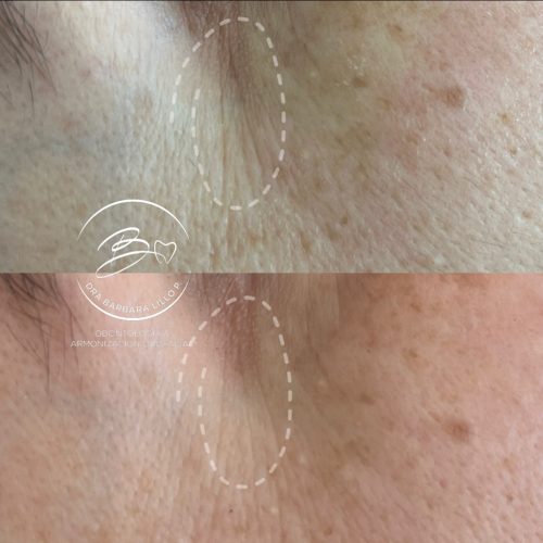 Viscoderm(1)