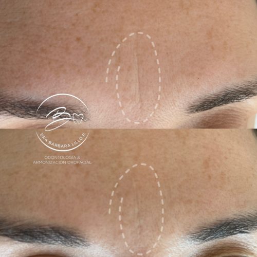Viscoderm(2)